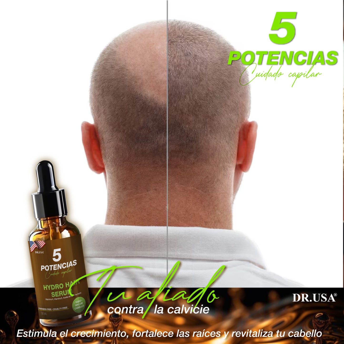 🌟 5 Potencias – Tratamiento Capilar Profesional 100% Natural